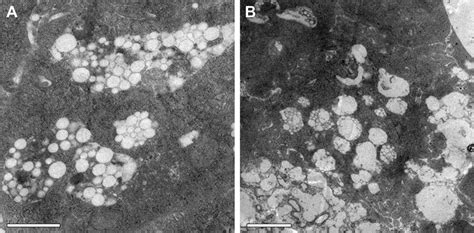 Intracellular Accumulation Of Nanospheres In Bmdcs Treated With Phyp