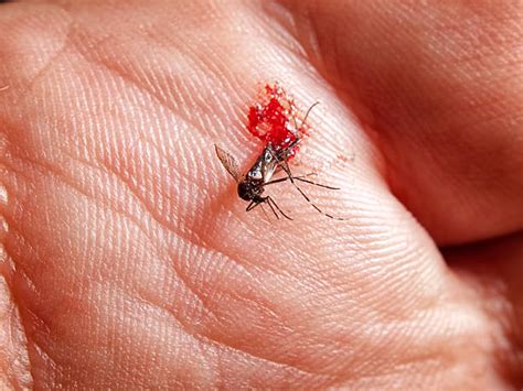 50 Killed Mosquito With Blood On Human Hand Stock Photos Pictures