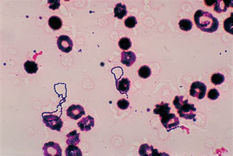 Streptococcus Bacteria Classification Shape Infection And Gram Stain