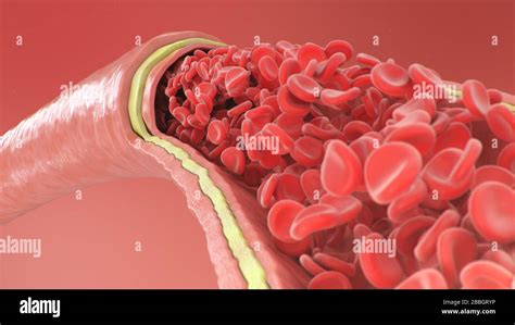 Gesunde Arterie Fotos Und Bildmaterial In Hoher Auflösung Alamy