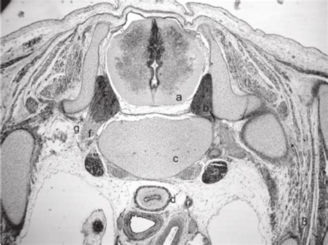 Sagittal Section Through The Thorax Of An Embryo At Stage 23 He ×