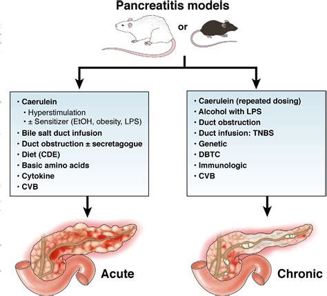 Figure 3 From Models Of Acute And Chronic Pancreatitis Semantic Scholar