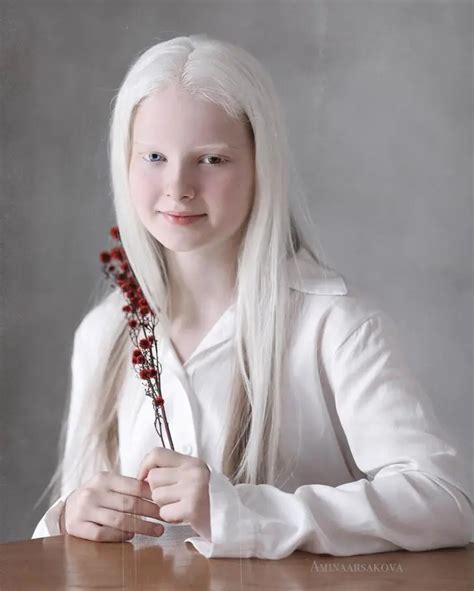Девочка альбинос из Чечни поразила своей уникальной внешностью
