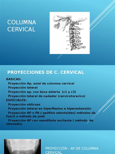 Enter the password to open this pdf file. Columna Cervical