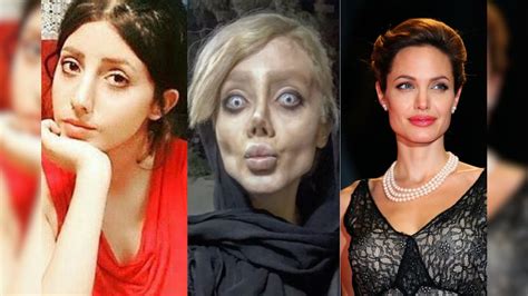 Teens Plastic Surgeries To Look Like Angelina Jolie May Have Gone