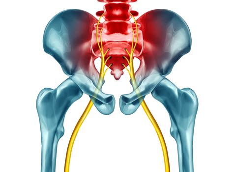 Having A Pinched Nerve In Your Lower Back Premia Spine Blog