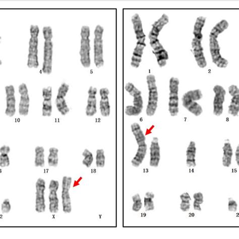 Performance Of Nipt For Detecting Sex Chromosome Abnormality Download Scientific Diagram