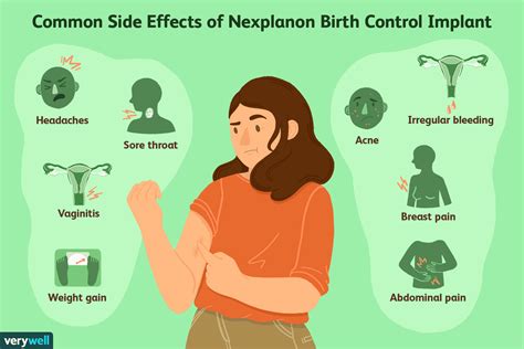 Nexplanon Was Sie über das Geburtenkontroll Implantat wissen sollten