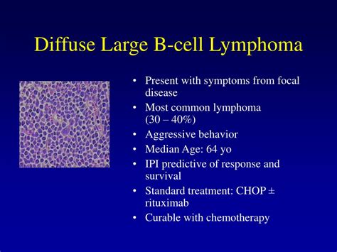 Ppt Lymphoma Presentation And Diagnosis Powerpoint Presentation Free