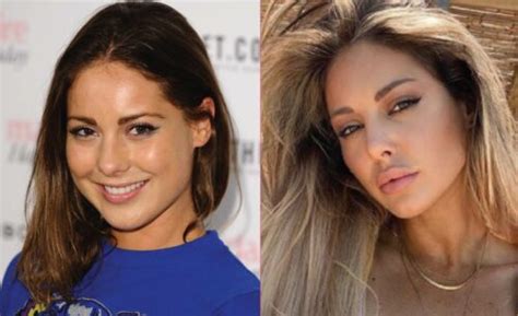 In these cases, customers do. Has Louise Thompson had cosmetic surgery?