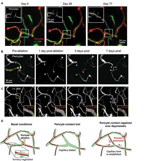Frontiers Pericyte Structural Remodeling In Cerebrovascular Health