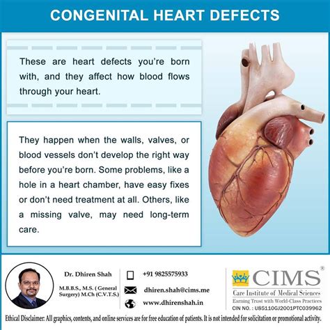 Congenital Heart Defects The Best Cardiac Surgeon In Ahmedabad And
