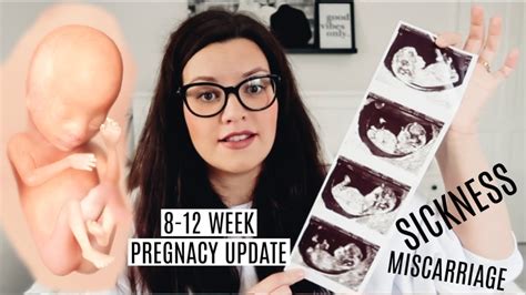 8 12 Week Pregnancy Update After Multiple Miscarriages Youtube