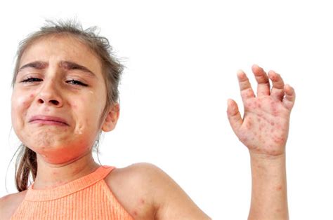 8 Unexpected Causes Of Summertime Rashes
