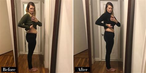 I Tried Sculpsure Fat Burning Laser Treatment After Giving