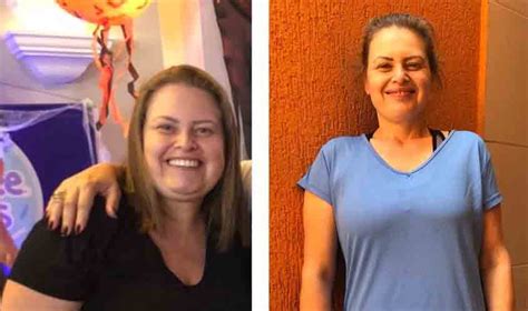 Não existe fórmula mágica: combate à obesidade requer atenção
