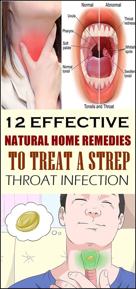 12 Effective Natural Home Remedies To Treat A Strep Throat Infection