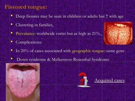 Oral Developmental Anomalies