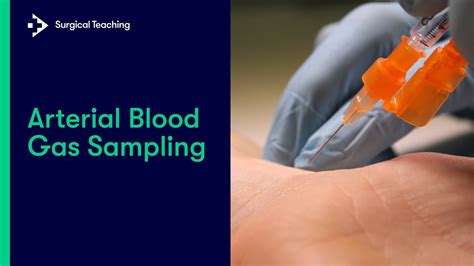Arterial Blood Gas Abg Sampling Everything You Need To Know To