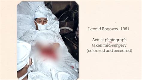 自分の盲腸を自分で切除手術した「ソ連の外科医ロゴゾフ」 2 2 ナゾロジー