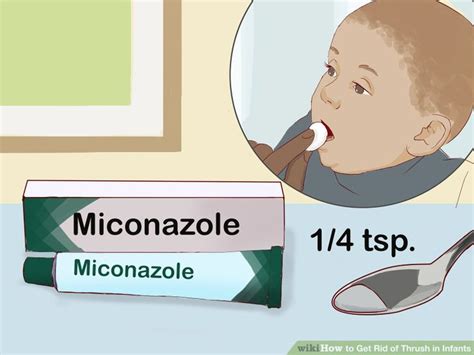 How To Get Rid Of Thrush In Infants