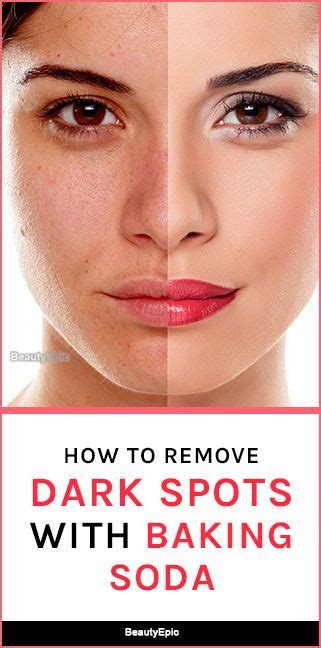 How To Use Baking Soda For Dark Spots Remove Dark Spots How To