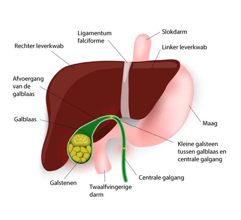 Processus falciformis, falciform ligament, ligamentum falciforme. Galstenen en Synofit: gaat dat samen? • Synofit