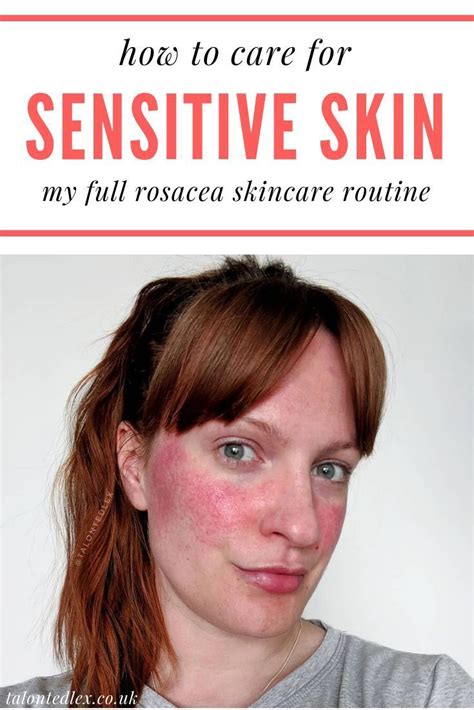 Sensitive Skin Tips For Those With Rosacea Sensitive Skin Care