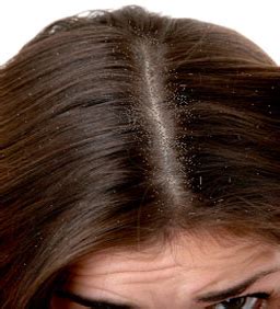 White hairs are typically a sign of aging, but they're not timekeepers — they can pop up whenever they feel like it. macaulogia: 8 straightforward ways that to induce ...