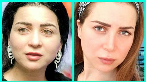 أما عملية الدلفنة فهي عبارة عن عملية ضبط المعدن بين إسطوانتين (دلفينين) دائرتين لماكينة الدلفنة ليشكل حسب الأشكال والأبعاد المطلوبة. مي عز الدين قبل التجميل , صور مي عز الدين زمان - هل تعلم