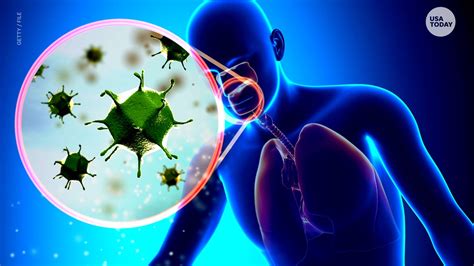 Influenza is different from a cold. Flu vs. coronavirus: Why influenza is more likely to ...