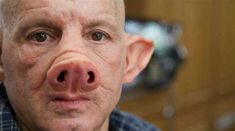 Scientists Have Successfully Made The First Human/Pig Hybrid