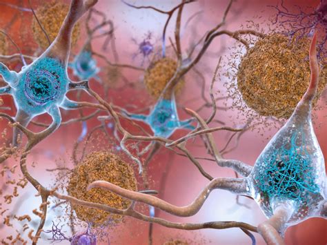 A Precise Look At Alzheimers Proteins Feature Pnnl