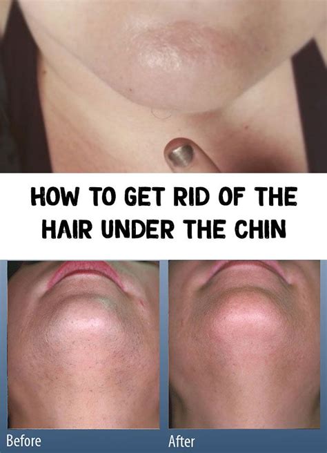 Get the tools that they trust. How to get rid of the hair under the chin | Chin hair ...
