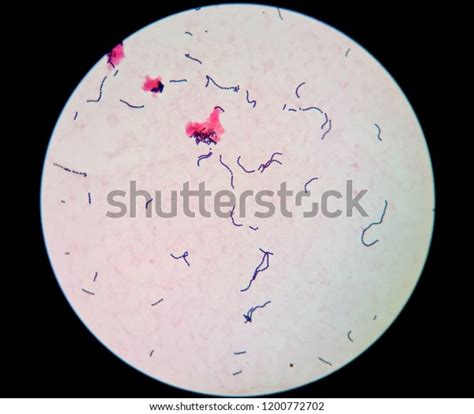 Gram Positive Cocci Chains Streptococcus Species Stockfoto Shutterstock