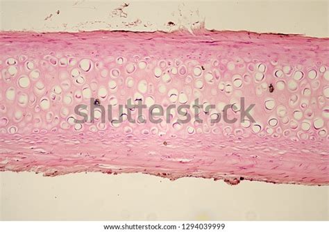 Human Hyaline Cartilage Section Under Microscope Stock Photo