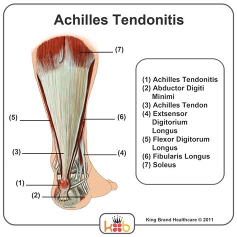 Golgi tendon organs are specialized receptors located in muscle tendons and are innervated by ib muscle afferents. King Brand Ankle Images