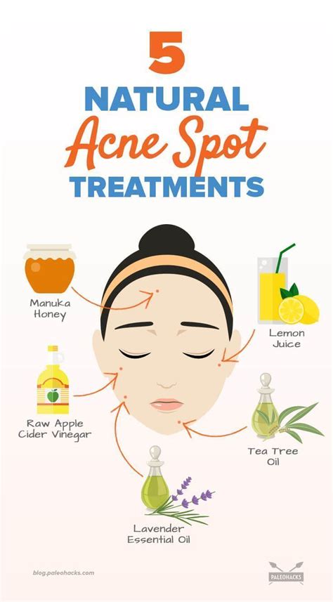5 Natural Acne Spot Treatments Natural Acne Treatment Natural Acne