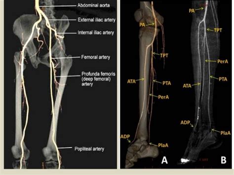 Arteries Of Leg Anatomy