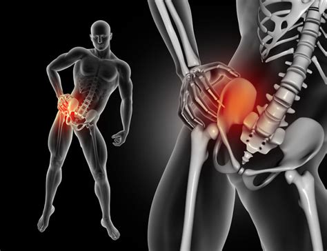 Does Chronic Hip Pain Require Hip Replacement Surgery Froggy And The