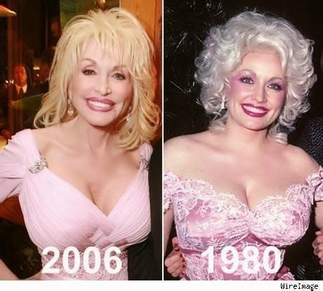 Dolly Parton Breast Implants Before After : Celebrity ...