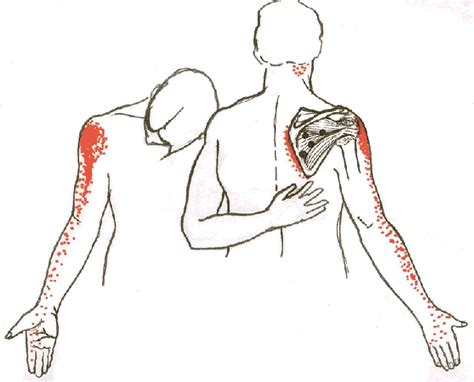 Likewise, the shoulder blades should be pulled back during any horizontal pulling movement (e.g. ROUND EARTH PUBLISHING: INTRODUCTION TO SHOULDER PAIN