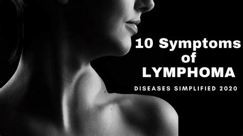 10 Symptoms Of Lymphoma Youtube