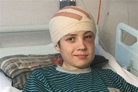 Teen 17 Dies After Battling Brain Tumour That Saw Him Branded Aande