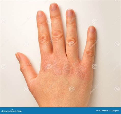 Withered Hand By Cold Weather Stock Photo Image Of Cropped Arid