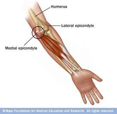 Tendons that help bend the elbow or rotate the forearm include: Climbing Fitness #2: Climber's Elbow - Gripped Magazine