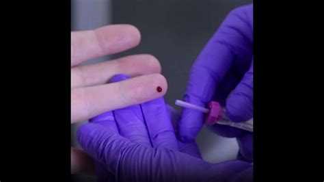 A Single Blood Test Can Detect 8 Types Of Cancer Youtube