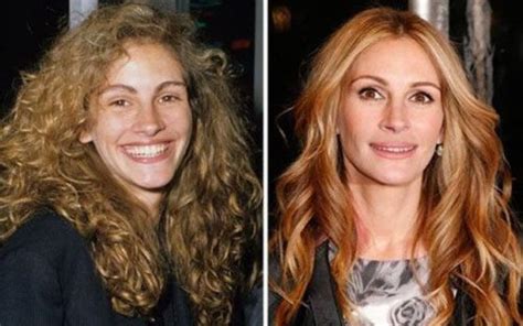 Julia Roberts Plastic Surgery Is The Pretty Woman All Natural