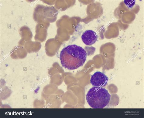 Eosinophilic Myelocyte Stock Photo 738505486 Shutterstock