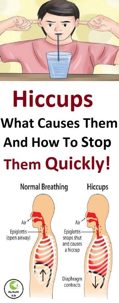 Hiccups What Causes Them And How To Stop Them Quickly Diy Health Health Hiccups Cause